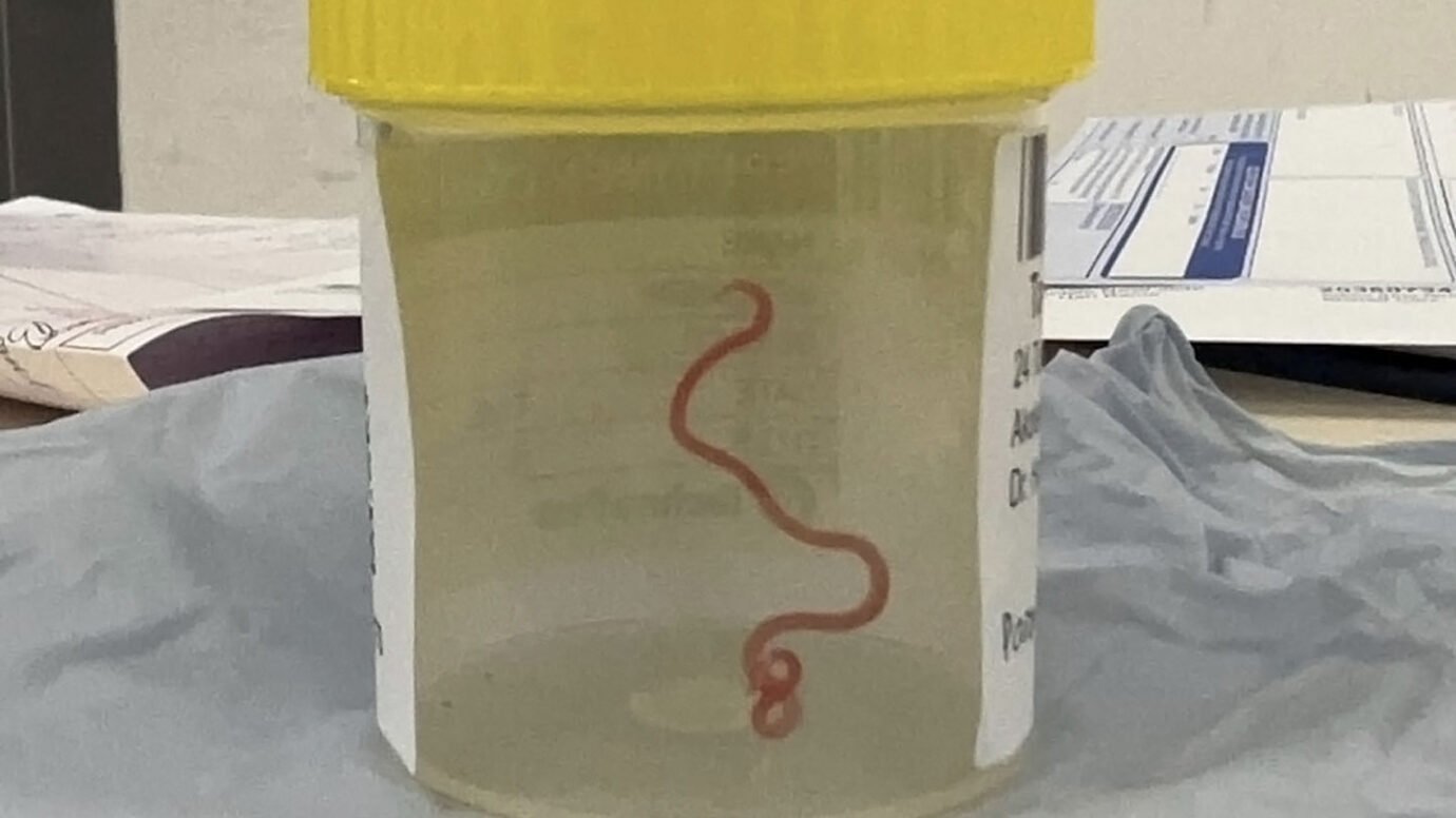 Australian Woman's Mysterious Symptoms Lead to Shocking Discovery of ...